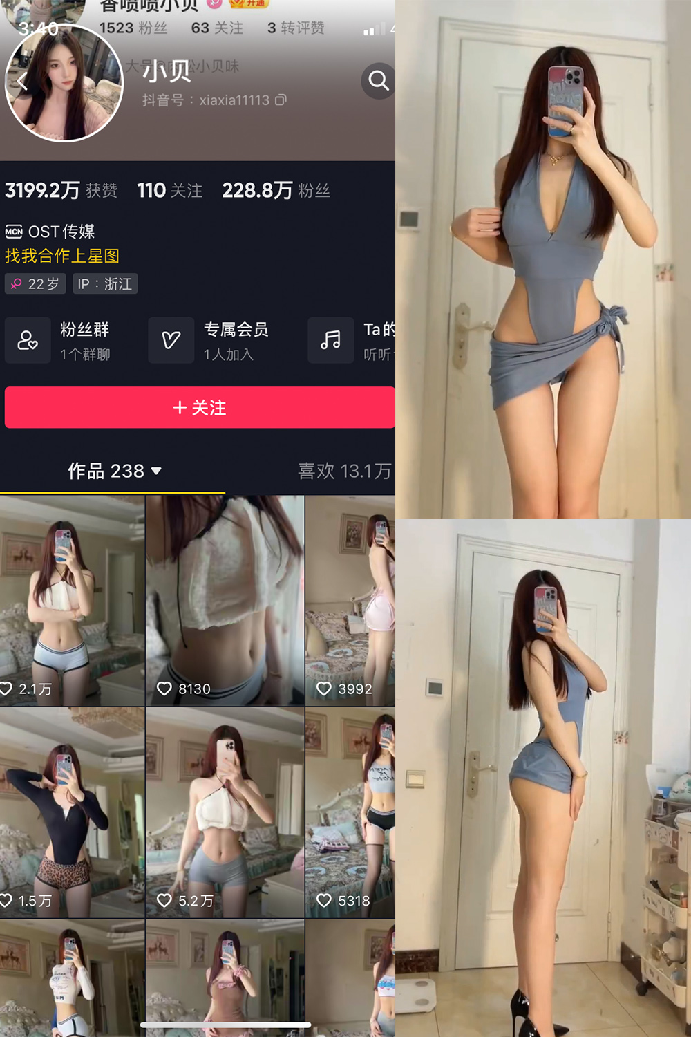 小贝